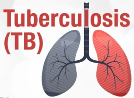 भारत में टीबी के मामलों में 16% की गिरावट दर्ज की गई: Annual India TB रिपोर्ट