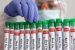 First Human Dies From H5N2 Bird Flu in Mexico