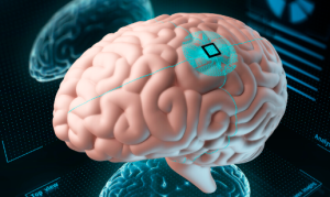 World’s First Brain Implant for Epilepsy Control