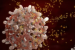 What is Radical CAR-T Therapy?