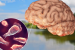 Rare and Fatal Brain-Eating Amoeba Infection