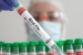 WHO Launches Project to Develop H5N1 Vaccines Using mRNA