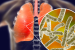 What is Legionnaires’ Disease?