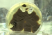 German Scientists Discover Plastic-Eating Fungi for Waste Reduction