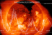 Astronomers Develop New Method to Predict Solar Cycle Amplitude