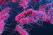 E. Coli Outbreak: Causes, Symptoms, and Prevention