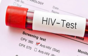 New Technology Enhances HIV Detection Accuracy