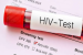 New Technology Enhances HIV Detection Accuracy