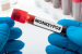 Breakthrough in Monkeypox Virus Research