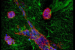 IISc Study uncovers Cancer Cell Adaptation During Migration