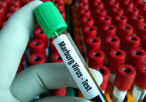 Rwanda Declares End to Marburg Virus Outbreak