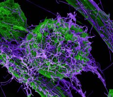 Ebola Virus Study Reveals Skin Transmission Route