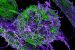 Ebola Virus Study Reveals Skin Transmission Route