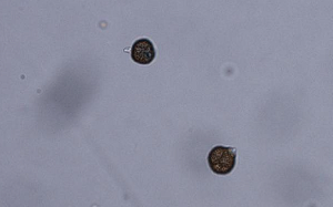 Epicoccum Indicum Fungi Species Discovered