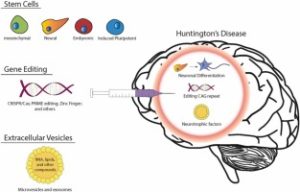 Huntington’s Disease Research Advances