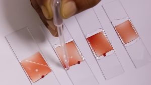 What is AnemiaPhone?