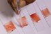 What is AnemiaPhone?
