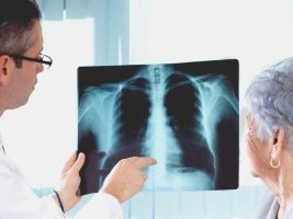 Double Pneumonia