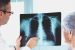 Double Pneumonia
