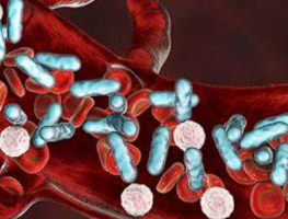 Neonatal Sepsis