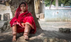 Filariasis Elimination Efforts in Kerala