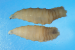 New World Screwworm Myiasis