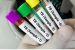 Surge in Paediatric Tuberculosis Cases in India