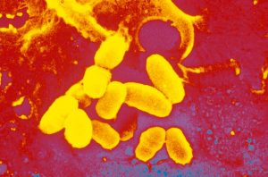 Diphtheria Outbreaks in Western Europe