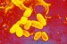 Diphtheria Outbreaks in Western Europe