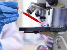 EMM-Negative Blood Group System