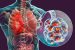 Legionnaires’ Disease
