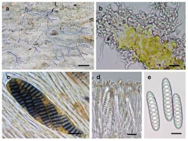 New Lichen Species in Western Ghats