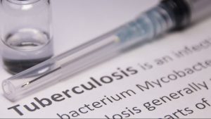 Tamil Nadu Launches Predictive Model for TB Mortality