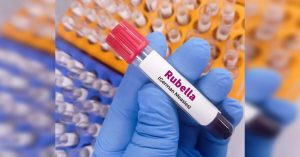 Nepal Achieves Rubella Elimination