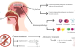 Primary Amoebic Meningoencephalitis