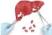 WHO Classifies Hepatitis D as Cancerous Virus
