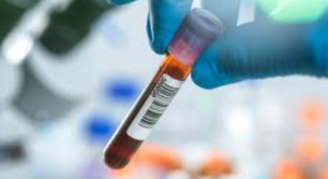 Servier India Launches Biomarker Testing Initiative for Cancer Diagnosis