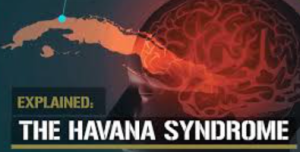Havana Syndrome Is Back in the Spotlight: Is It Linked to a Secret Pentagon Device?
