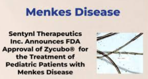 FDA Approves Zycubo For Rare Menkes Disease