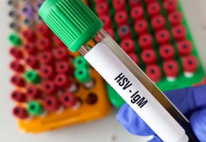 HSV Outbreak in Jalpaiguri Jail Leaves Seven Dead