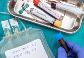 New Blood Test Detects Early Alzheimer’s Through Protein Changes