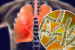 Legionnaires’ Disease Surge Raises Urban Water Safety Concerns