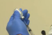 Lyme Disease Vaccine Shows Promising Trial Results
