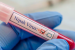 Kerala Reports Fresh Nipah Virus Case