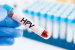 India Validates First Indigenous HPV Test