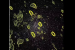 GMRT Discovers Five New Pulsars in Ancient Star Clusters