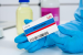 Teplizumab Becomes First Type 1 Diabetes Delay Drug on NHS