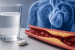 FDA Approves First Oral PCSK9 Inhibitor